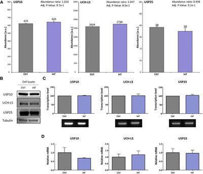 Modified activities of macrophages’ deubiquitinating enzymes after Francisella infection